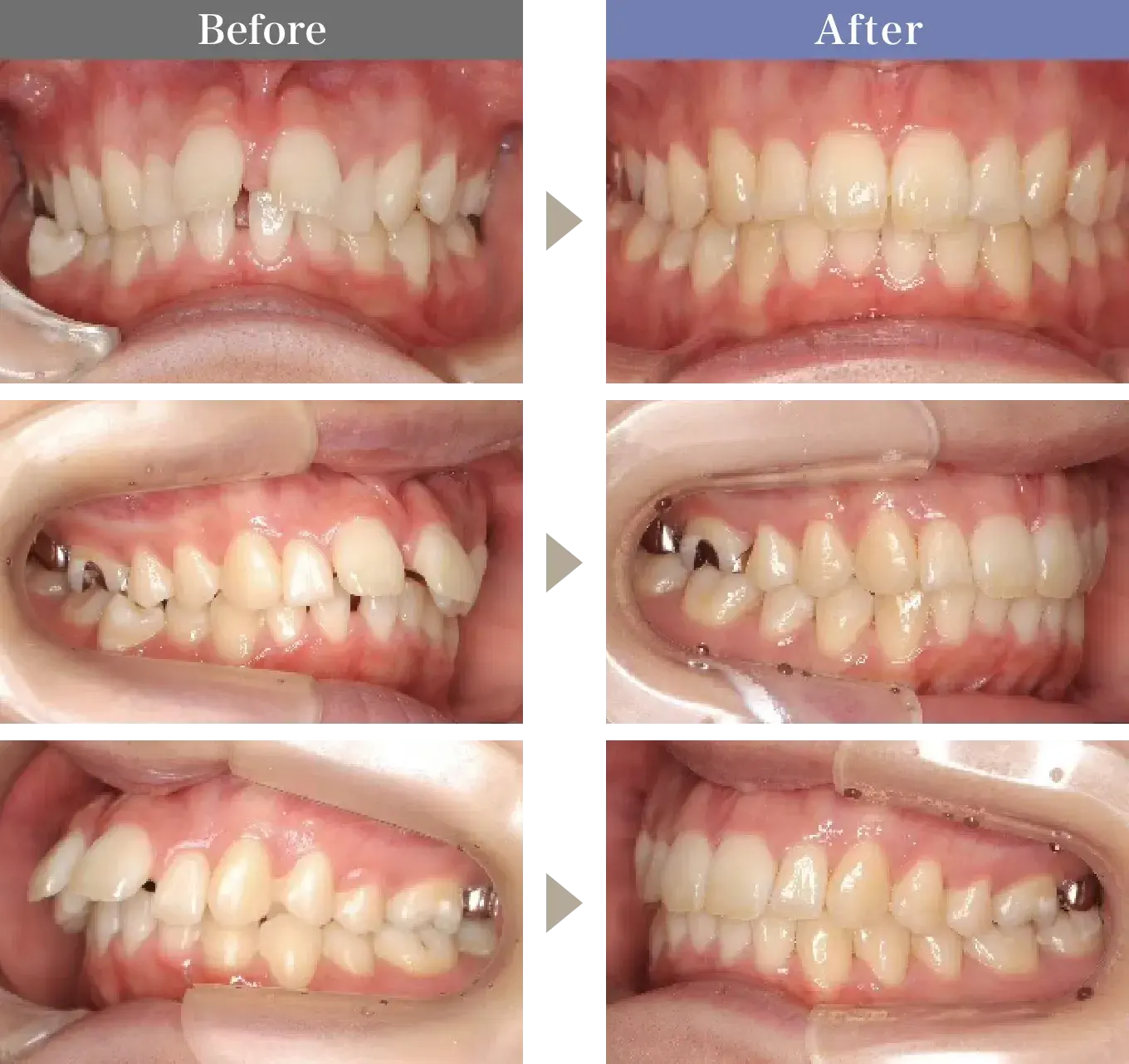 Before / After