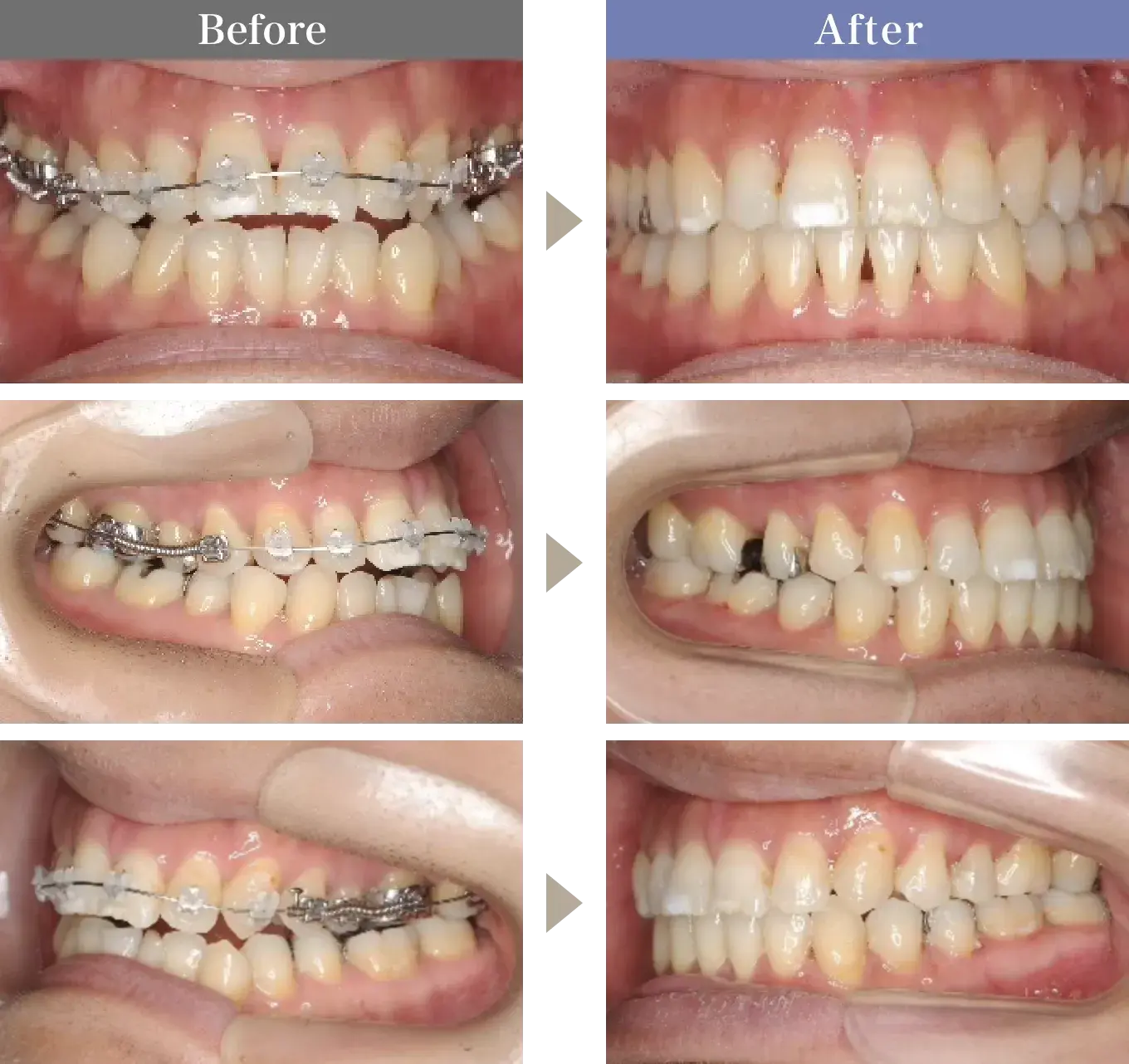 Before / After
