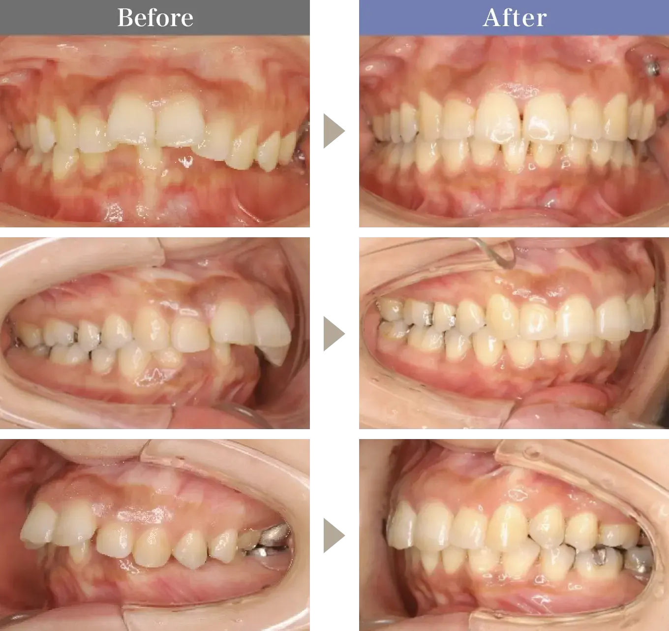 Before / After