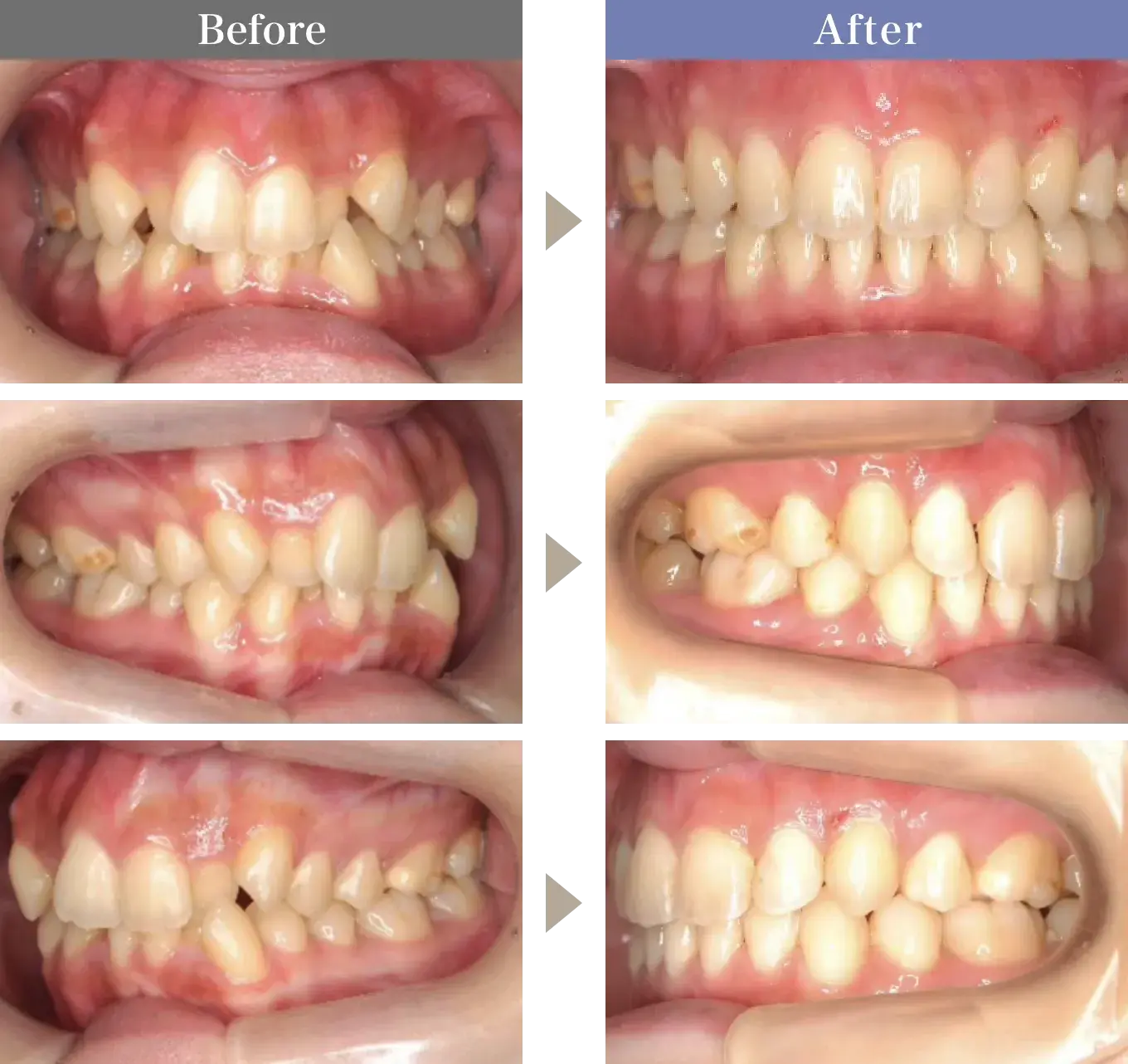 Before / After