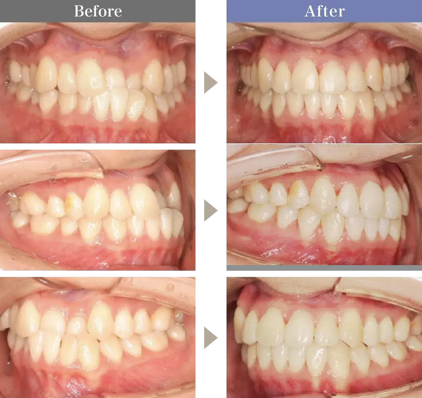 Before / After